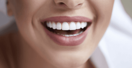 Digital Smile Designing
