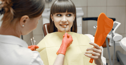 Veneers
