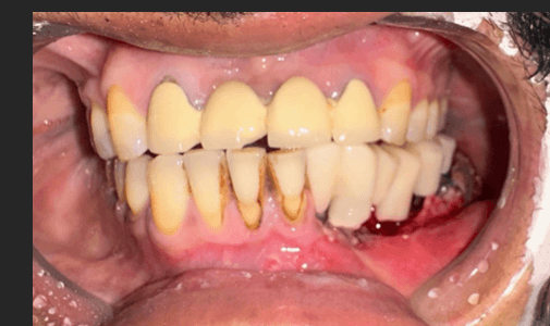 Figure 6a