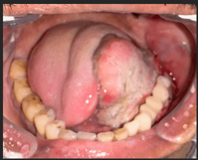 Figure 6b