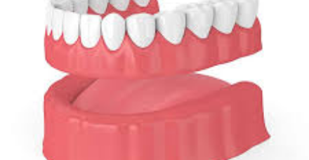 Complete Dentures